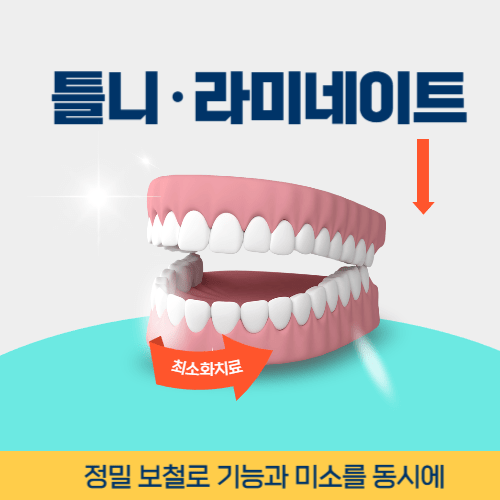 경기광주치과 경기도 광주시 치과 틀니 라미네이트
