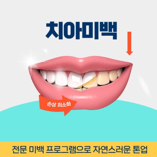 경기광주치과 경기도 광주시 치과 치아미백