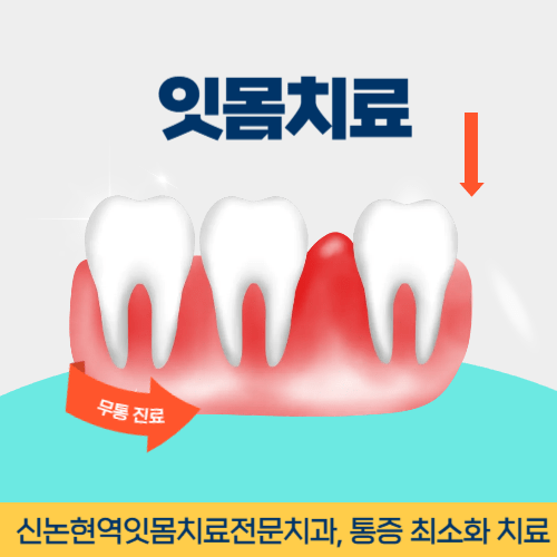 경기광주치과 경기도 광주시 치과 잇몸치료
